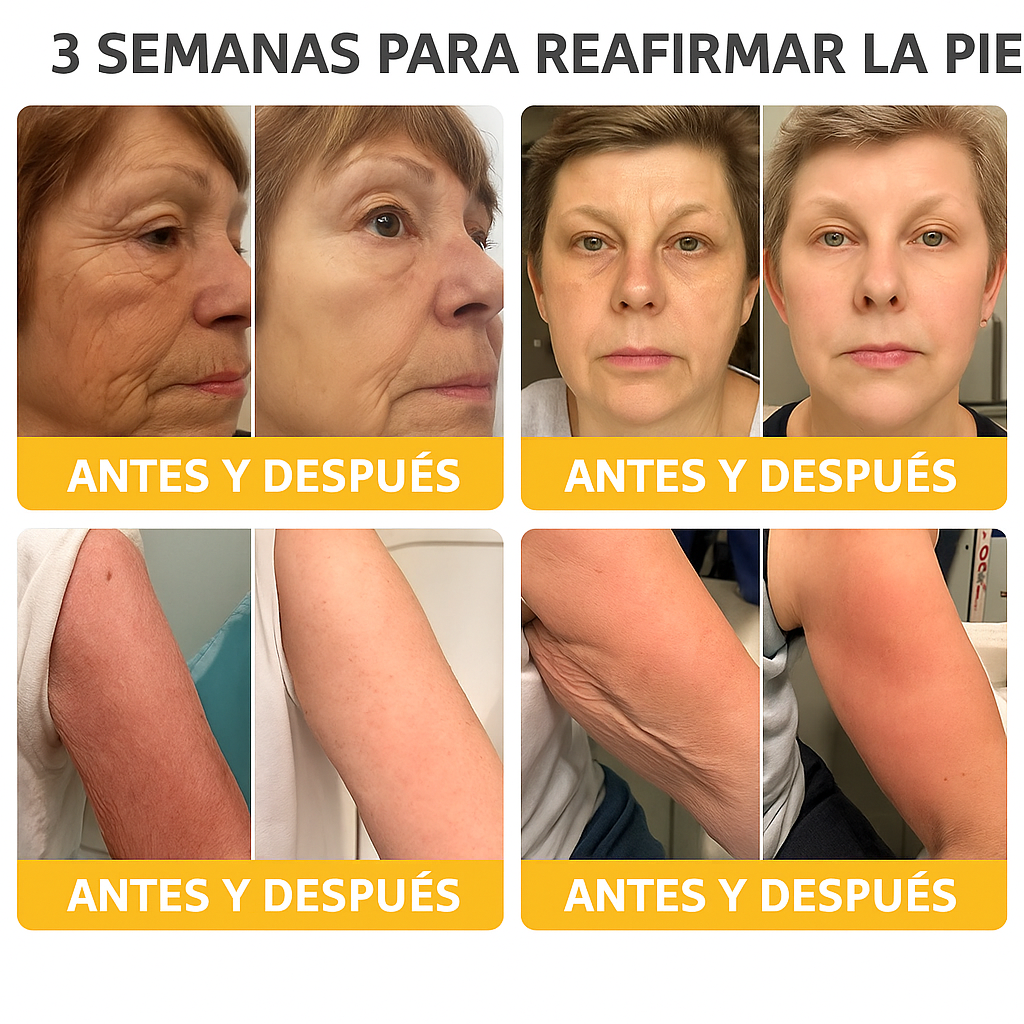 BeeLift – Crema Reafirmante Antienvejecimiento